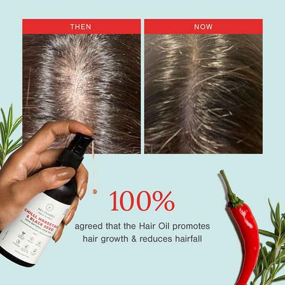 Chilly, Horsetail & Black Seed Organic Hair Serum - For Hair Growth - 100ml | Verified Sustainable Hair Oil on Brown Living™